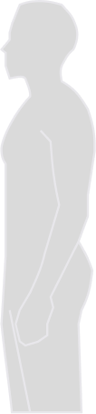 side-photo